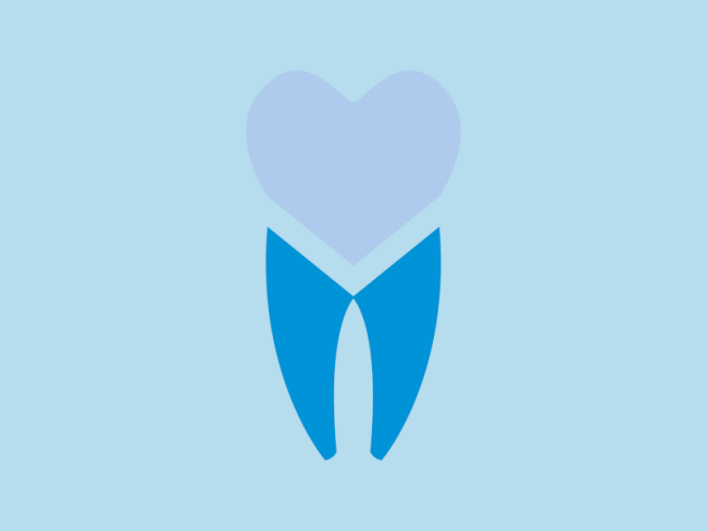 Laminat, fasade, veneers